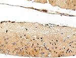 WASF3 Antibody in Immunohistochemistry (Paraffin) (IHC (P))