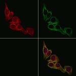 IL13RA2 Antibody in Immunocytochemistry (ICC/IF)