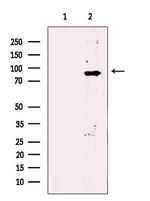 PLA2G6 Antibody in Western Blot (WB)