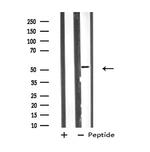 VRK3 Antibody in Western Blot (WB)