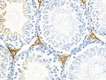 RALBP1 Antibody in Immunohistochemistry (Paraffin) (IHC (P))