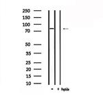 TRIF Antibody in Western Blot (WB)