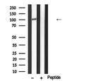 TTK Antibody in Western Blot (WB)