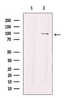 TTK Antibody in Western Blot (WB)