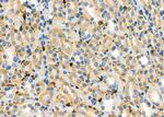 NQO2 Antibody in Immunohistochemistry (Paraffin) (IHC (P))