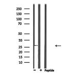 NQO2 Antibody in Western Blot (WB)