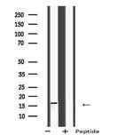 RT28 Antibody in Western Blot (WB)