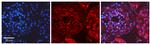 Myosin Skeletal Muscle Antibody in Immunohistochemistry (IHC)