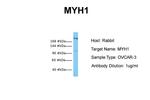 Myosin Skeletal Muscle Antibody in Western Blot (WB)