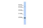 RBPMS2 Antibody in Western Blot (WB)