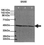 SNX6 Antibody in Western Blot (WB)