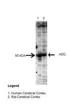 ADC Antibody in Western Blot (WB)