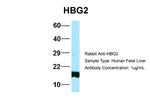 HBG2 Antibody in Western Blot (WB)