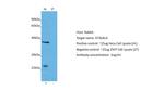 ST3GAL4 Antibody in Western Blot (WB)