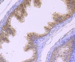 MSI2 Antibody in Immunohistochemistry (Paraffin) (IHC (P))