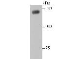 PFAS Antibody in Western Blot (WB)