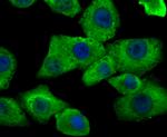 HIP1 Antibody in Immunocytochemistry (ICC/IF)