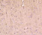 HIP1 Antibody in Immunohistochemistry (Paraffin) (IHC (P))