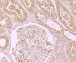 DIAPH3 Antibody in Immunohistochemistry (Paraffin) (IHC (P))