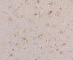 CACNG4 Antibody in Immunohistochemistry (Paraffin) (IHC (P))