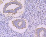 CACNB3 Antibody in Immunohistochemistry (Paraffin) (IHC (P))