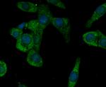 CACNG5 Antibody in Immunocytochemistry (ICC/IF)