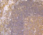 CD40 Antibody in Immunohistochemistry (Paraffin) (IHC (P))