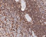 CD43 Antibody in Immunohistochemistry (Paraffin) (IHC (P))