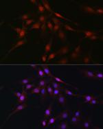 C9orf72 Antibody in Immunocytochemistry (ICC/IF)