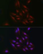 C9orf72 Antibody in Immunocytochemistry (ICC/IF)