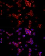 CD19 Antibody in Immunocytochemistry (ICC/IF)