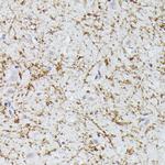 CLN8 Antibody in Immunohistochemistry (Paraffin) (IHC (P))