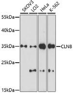 CLN8 Antibody in Western Blot (WB)