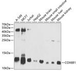 COX6B1 Antibody in Western Blot (WB)