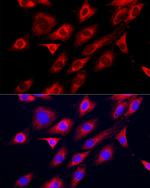 GAMT Antibody in Immunocytochemistry (ICC/IF)