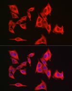 GAMT Antibody in Immunocytochemistry (ICC/IF)