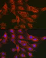 GART Antibody in Immunocytochemistry (ICC/IF)