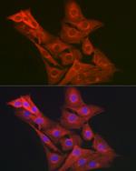 GART Antibody in Immunocytochemistry (ICC/IF)