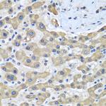 GFM1 Antibody in Immunohistochemistry (Paraffin) (IHC (P))