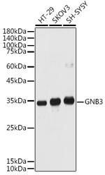 GNB3 Antibody in Western Blot (WB)