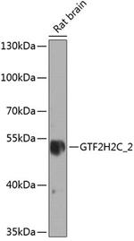 GTF2H2C Antibody in Western Blot (WB)