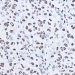 Histone H1.0 Antibody in Immunohistochemistry (Paraffin) (IHC (P))