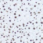 Histone H1.0 Antibody in Immunohistochemistry (Paraffin) (IHC (P))