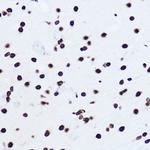 Histone H1.0 Antibody in Immunohistochemistry (Paraffin) (IHC (P))