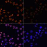 H2BK12ac Antibody in Immunocytochemistry (ICC/IF)