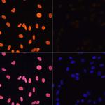 H3K4ac Antibody in Immunocytochemistry (ICC/IF)