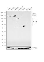 LAMC2 Antibody in Western Blot (WB)