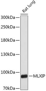 MLXIP Antibody in Western Blot (WB)