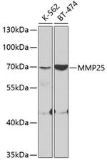 MMP25 Antibody in Western Blot (WB)