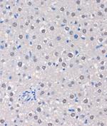 MTMR8 Antibody in Immunohistochemistry (Paraffin) (IHC (P))